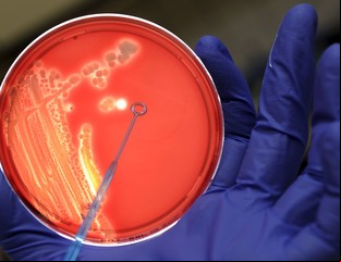La ciencia elegirá a 80 chicos para probar la primera cura de una temible enfermedad