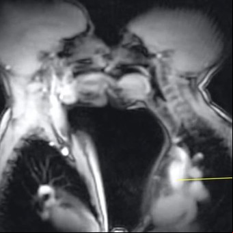 Sexo en rayos X: un video muestra cómo reaccionan los cuerpos