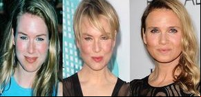 ¿Qué le pasó a Renée Zellweger?