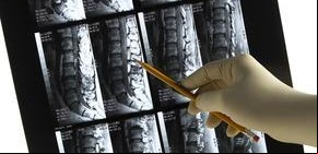 Escoliosis en niños: nuevos métodos para tratarla