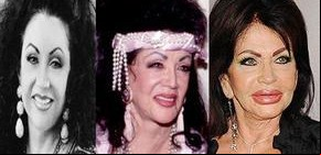 Jackie Stallone: la metamorfosis de la reina de las cirugías 