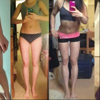 ¿Es sexy el "thigh gap"? El espacio entre muslos, la última obsesión adolescente