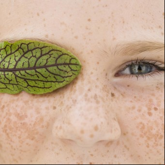 Conjuntivitis: qué hacer ante los primeros síntomas