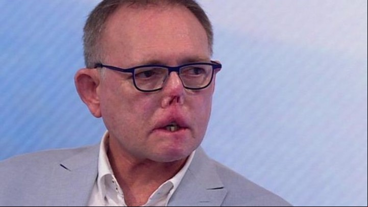 El doctor Nel vivió un cambio de vida tremendo al sufrir una infección extraña. Foto: Captura video.