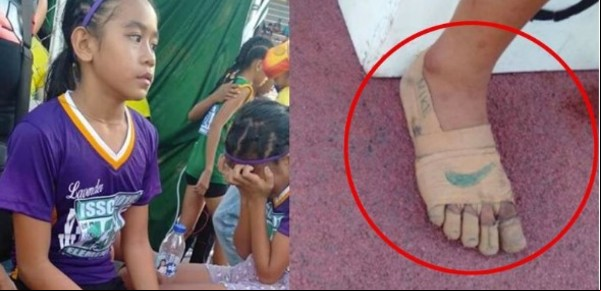 La nena que ganó 3 medallas de oro con unas zapatillas dibujadas en sus pies