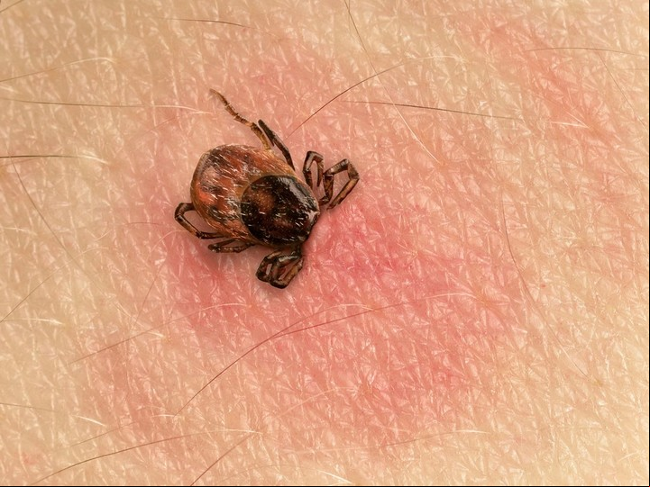La bacteria Borrelia burgdorferi, presente en un tipo de garrapatas que habita en ciervos, es la transmisora de la enfermedad de Lyme.
