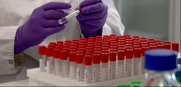Coronavirus: por qué no solo la edad y las enfermedades previas condicionarían los casos más graves
