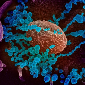 Coronavirus: un pequeño trozo de proteína podría ser el "arma secreta" que lo hace tan infeccioso y virulento