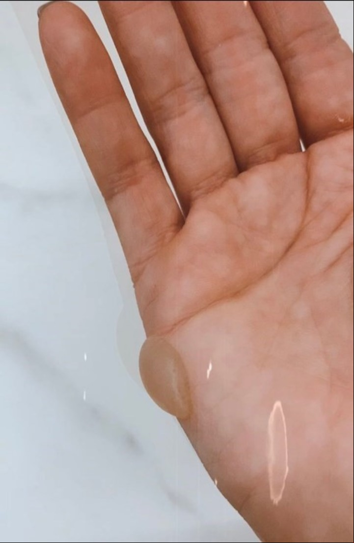 La herida de Sofía Pachano.