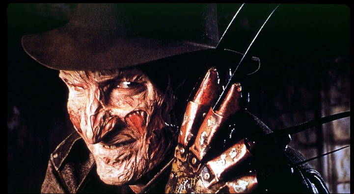 Por su rara condición en la piel, a Kira la comparan con Freddy Krueger, el personaje de ficción.