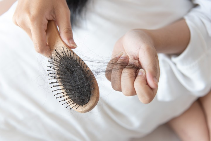 Recomiendan usar un cepillo de cerdas suaves, tant9o para la caspa como por la caída del cabello. Foto Shutterstock.