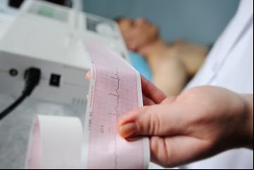 Más que dolor de pecho: otros síntomas del infarto que no hay que subestimar