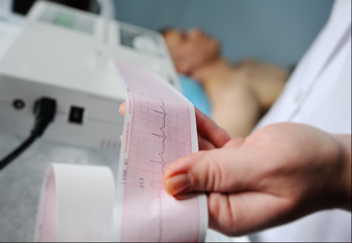 Un electrocardiograma o un holter ayudan a confirmar el diagnóstico. Foto Shutterstock.