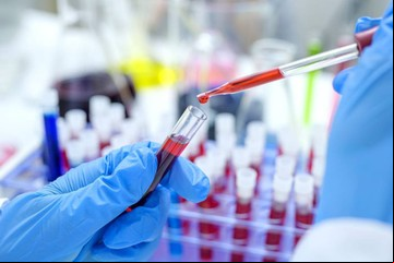 "El paciente de Ginebra": superó el VIH tras un trasplante de médula ósea y abre una nueva esperanza
