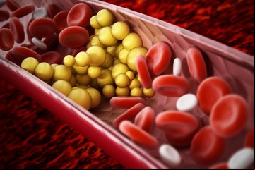 Los triglicéridos altos suben el riesgo de infarto y ACV, aunque el colesterol esté bien: cómo bajarlos
