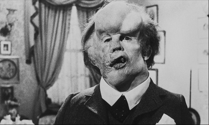 John Hurt en "El hombre elefante", la segunda película de Lynch, que fue candidata al Oscar (y él, como mejor director y guionista).