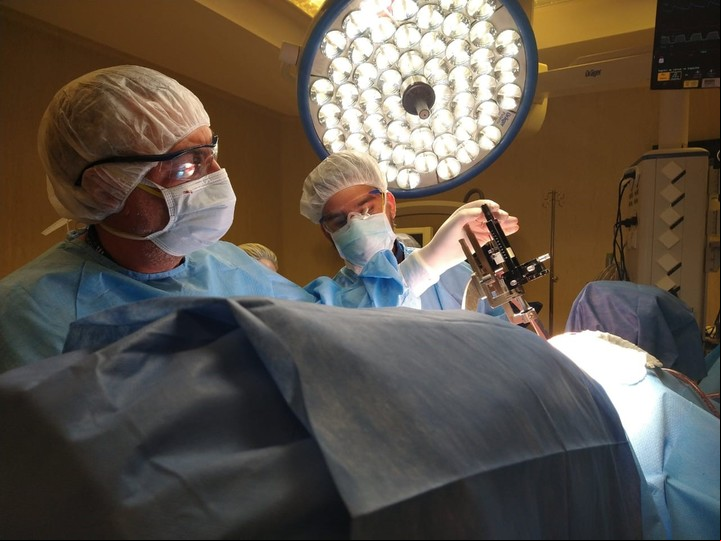 Implante del electrodo en el área del cerebro a tratar. Foto: Hospital Italiano de Buenos Aires.