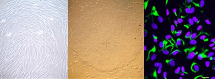 Mediante reprogramación celular, investigadores del instituto Leloir, en Argentina, transforman células de la piel (izq.) en células madre (centro), y más tarde las redirigen a ser neuronas (der.).