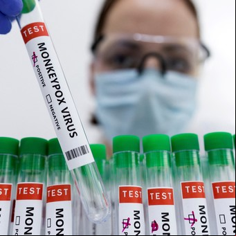 El brote de viruela del mono representa una "amenaza real" para la salud pública