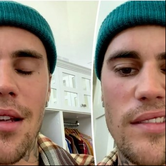 Justin Bieber reanuda su gira mundial tras cancelarla por su parálisis facial