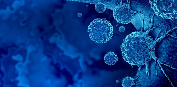 Diferentes tipos de cáncer tienen en común el comportamiento anormal de algunas células. Ilustración Shutterstock