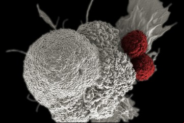 Jaque al cáncer: las claves de una terapia con resultados alentadores