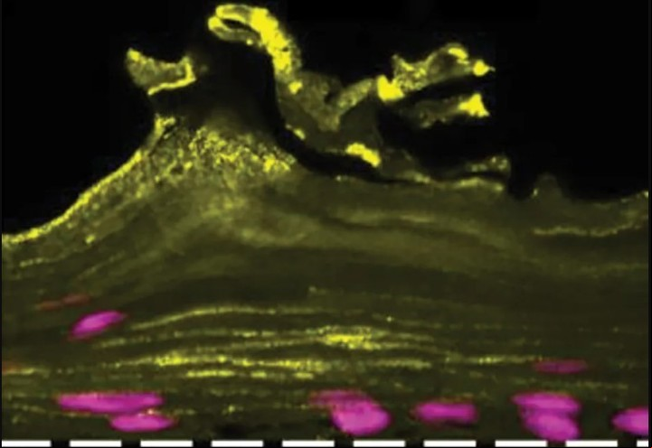 Un "chip de la vagina" que muestra el recubrimiento interior de la vagina, que consta de distintas capas y estructuras de tejidos en amarillo