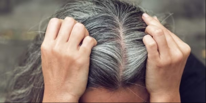 La aparición de las canas se puede deber a distintos factores.