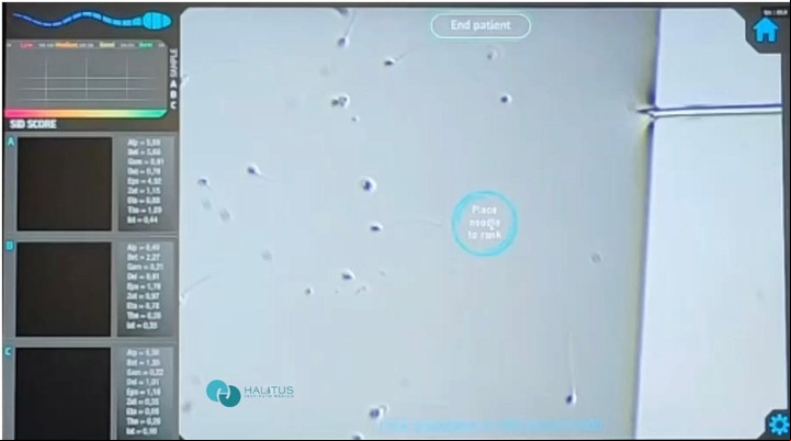 Selección de espermatozoides por inteligencia artificial