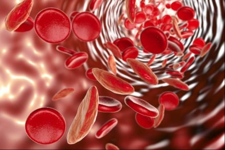Anemia, sinónimo de cansancio.