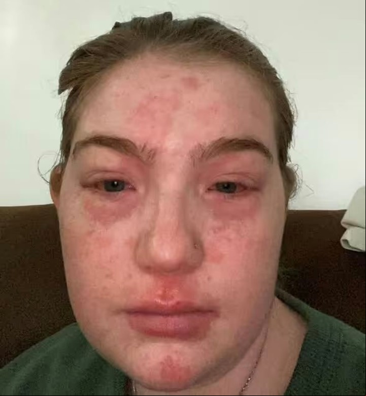 La joven de 22 años aún no encuentra una respuesta certera a su rara condición. Foto: Twitter.