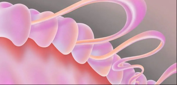 Gingivitis, causas y consecuencias de la "enfermedad silenciosa" que persiste en la boca