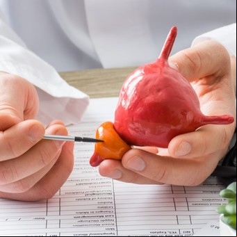 Qué alimentos y bebidas se deben evitar cuando está la próstata inflamada