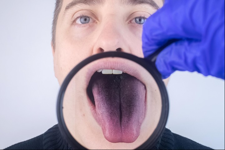 Expertos de la Universidad de Harvard se manifestaron sobre la lengua.