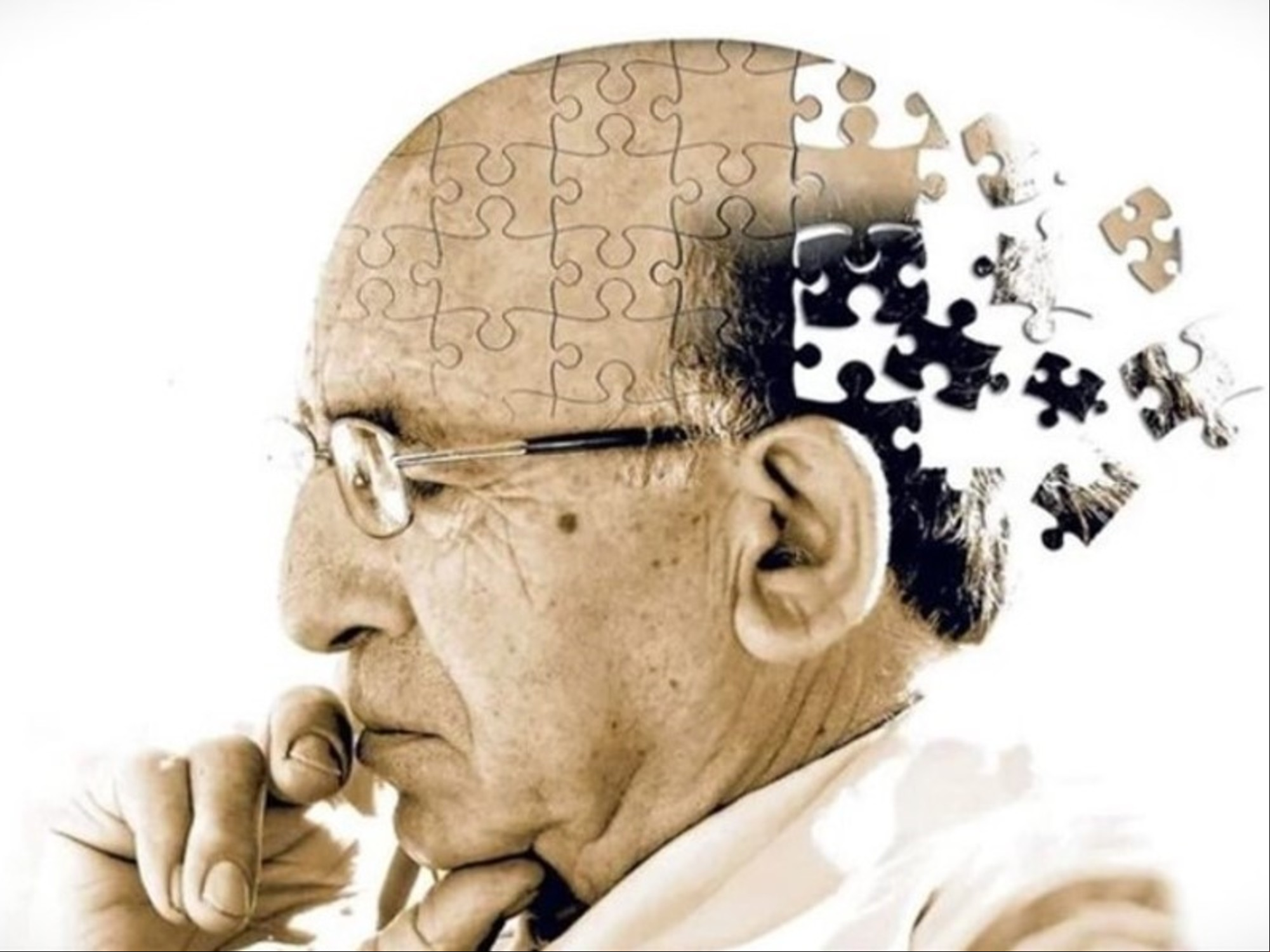 Alzheimer deterioro cognitivo cerebro