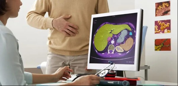 ¿Afecta a la salud vivir sin vesícula?, expertos médicos responden