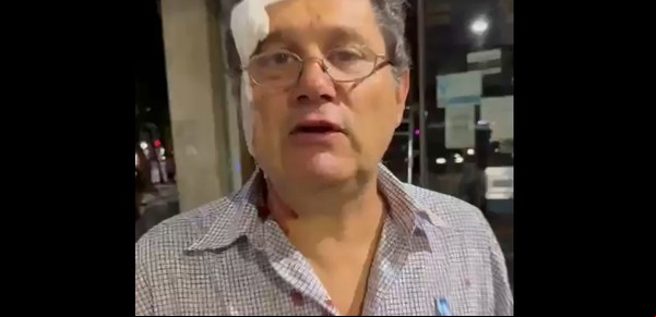 Un militante de Javier Milei fue golpeado frente al Congreso: “Están entongados, vienen y agreden”