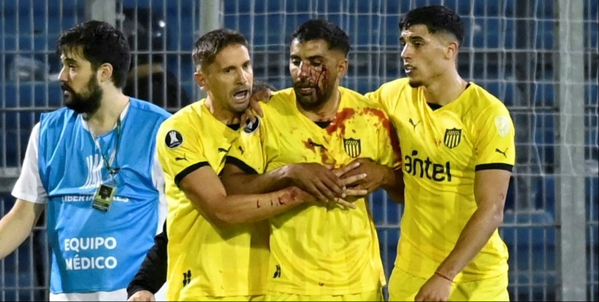 Escándalo tras escándalo en la cancha de Rosario Central: un jugador de Peñarol recibió un piedrazo, se desmayó en el vestuario y fue internado