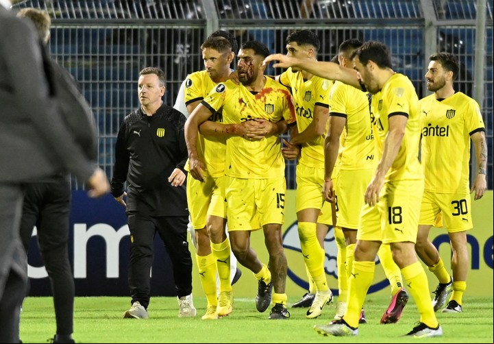 Maximiliano Olivera camina junto a sus compañeros rumbo al vestuario visitante del Gigante de Arroyito tras ser agredido con una pedrada. Foto: Marcelo Manera / AFP.