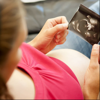 Los tests genéticos que se pagan en dólares y cada vez se hacen más embarazadas