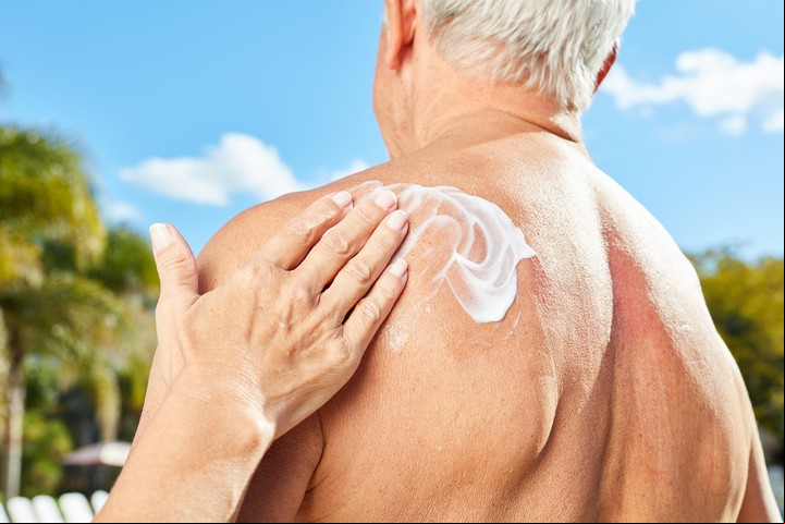 El uso del protector solar puede prevenir el cáncer de piel.