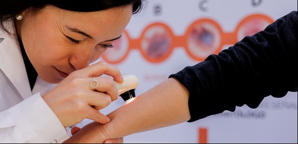 Chequeo de lunares en todo el país para democratizar el  a la dermatología