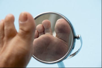Diabetes: las señales de alarma que hay que buscar en los pies para evitar amputaciones