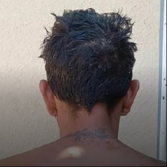 Mordeduras, cascotazos y patadas: la odisea de los policías para capturar a "Maicho" en Corrientes