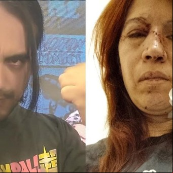 Sobrevivió a 30 cuchilladas en una pizzería de Núñez: "No me mató, pero arruinó todo lo que tenía"