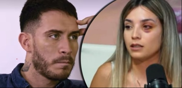 La hermana de Emily Ceco mostró las heridas que sufrió la participante de "Love is Blind" de parte de Santiago: las imágenes