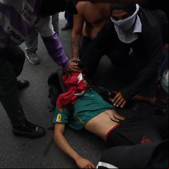 El fotógrafo Pablo Grillo sigue estable y su papá pidió "mucho cuidado" para la marcha de este miércoles 