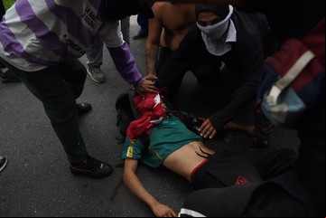 El fotógrafo Pablo Grillo sigue estable y su papá pidió "mucho cuidado" para la marcha de este miércoles 