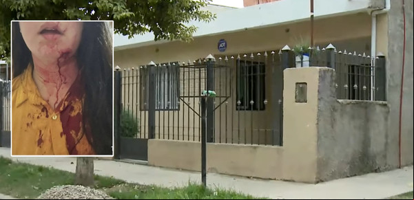 Crece la violencia contra la Policía en Córdoba: atacan a golpes a una cadete que terminó con fractura de mandíbula y lesión en el cráneo